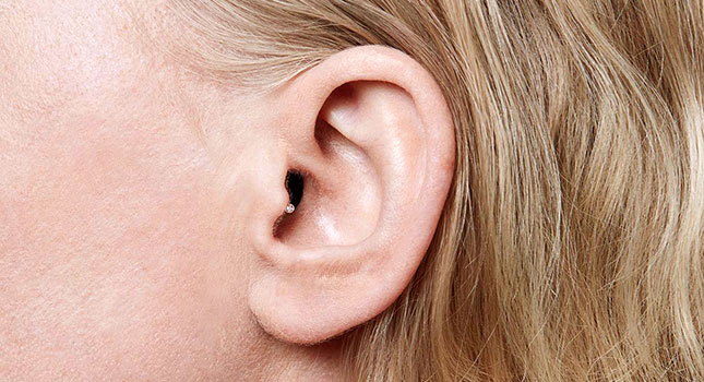 Невидимый слуховой аппарат в ухе