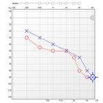 Что такое аудиограмма