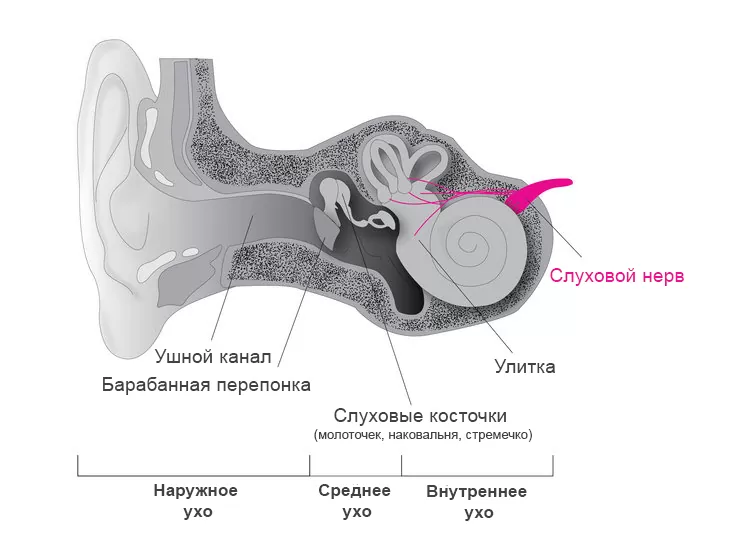 Слуховая аудиторная нейропатия Слуховая (аудиторная) нейропатия