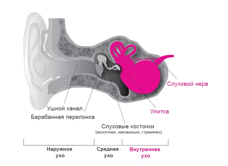 Нейросенсорная тугоухость Нейросенсорная тугоухость