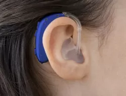 Слуховой аппарат Oticon Xceed Play BTE UP