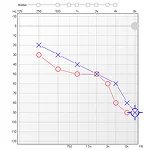 Что такое аудиограмма