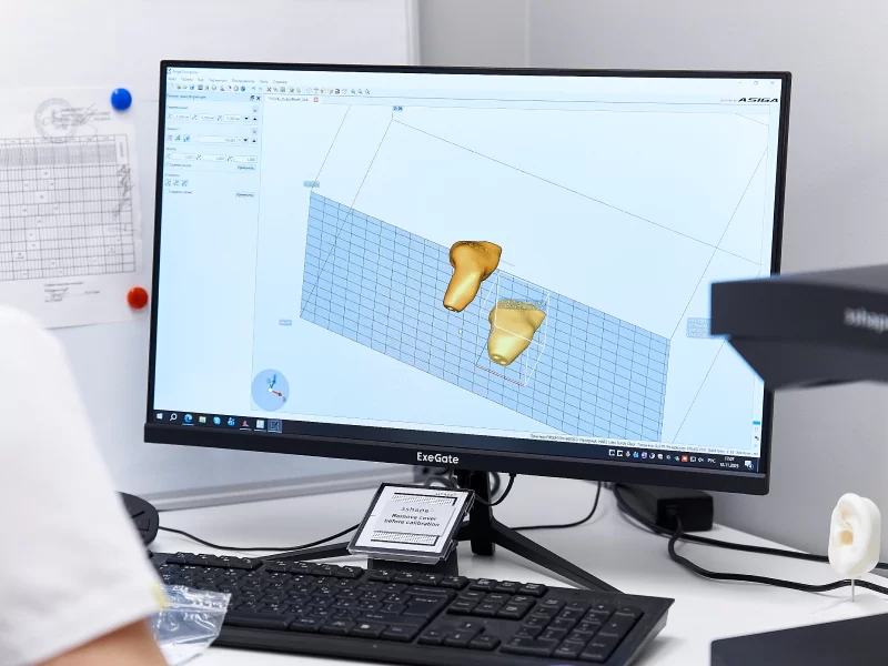 3D моделирование вкладышей